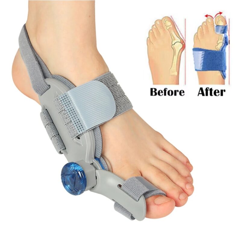 Bunion Corrector Orthopedic