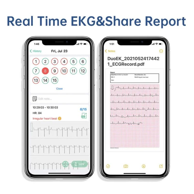 Pocket ECG Monitoring Device with OLED Screen Bluetooth - Image 6