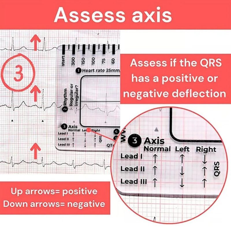ECG/EKG 7 Step Ruler Card Portable ECG-Interpretation - Image 2