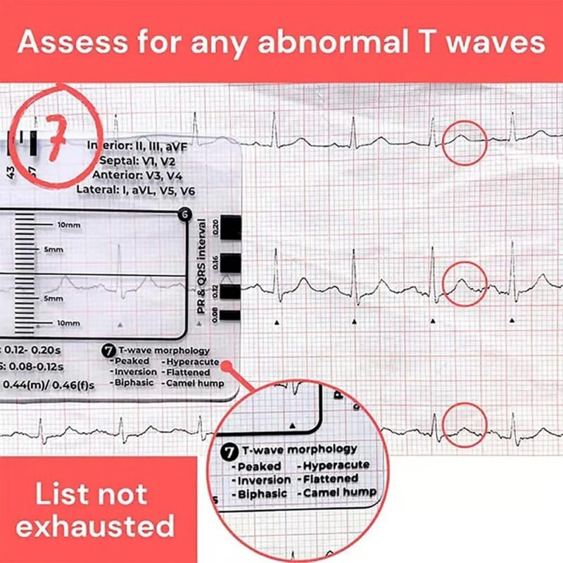 ECG/EKG 7 Step Ruler Card Portable ECG-Interpretation - Image 3