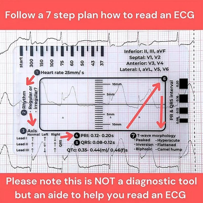 ECG/EKG 7 Step Ruler Card Portable ECG-Interpretation - Image 4